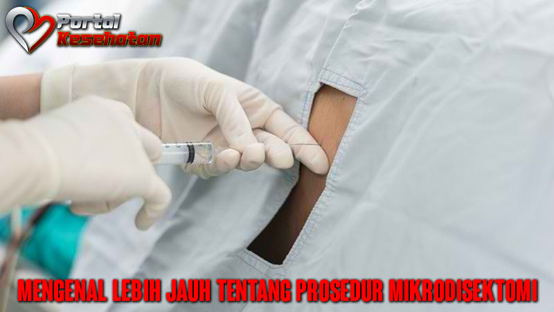 Mengenal Lebih Jauh Tentang Prosedur Mikrodisektomi