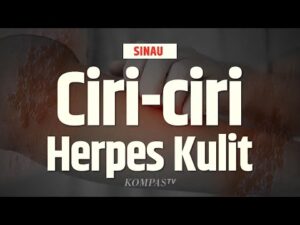 Bahaya Penyakit Herpes